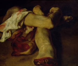 Anatomiske stykker (olie på lærred) af Theodore Gericault