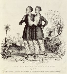 De siamesiske brødre, 18 år, trykt af Charles Hullmandel (1789-1850), ca. 1829