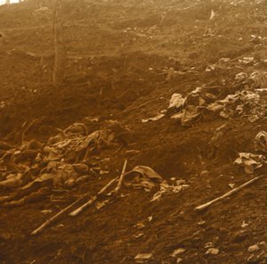 Efter angrebet, Les Éparges, Nordfrankrig, 1915. af Unbekannt