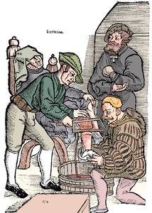 Amputation af et ben uden bedøvelse, 1593 af Unbekannt