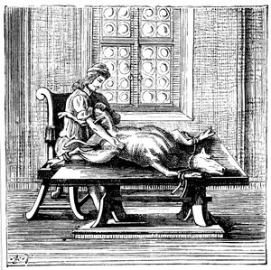 Dyre-til-menneske blodtransfusion, 1679 af Unbekannt