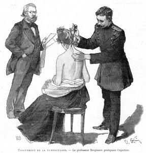 Professor Bergmann injicerer en tuberkulosepatient, 1891 af Unbekannt