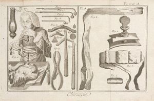 Trefination af Unbekannt