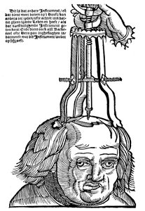 Trephination, 1593 af Unbekannt