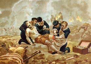 Ambroise Pare Medicine og fransk kirurg (ca. 1509-1590) praktiserer ligering af arterier efter amputation. af efter hombres y Mujeres celebres. Barcelona 1877. af Unknown artist