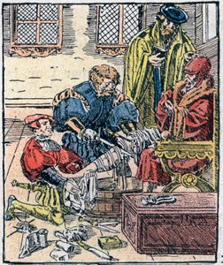 Amputation af et ben i det 16. århundrede. af Unknown artist