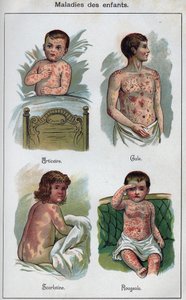 Sygdomme hos børn: Nældefeber, mæslinger, fnat, skarlagensfeber. I "Den nye naturlige medicin"" af F.E. Bilz. af Unknown artist