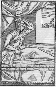 Næseoperation: Rekonstruktionskirurgi på næsen i “De curtorum chirurgia per insitionem””. Venedig af Unknown artist