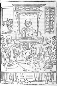 Anatomisk dissektion. Gravering fra en afhandling om medicin af Gerolamo Cardano (Cardanus Hieronymus), Firenze af Unknown artist