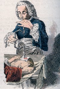 Trepanationen. 1700-tals tryk. af Unknown artist