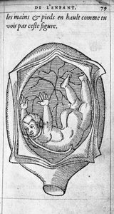 Fosterets position i livmoderen under graviditeten. Gravering fra "" De la generation des enfants"" af den franske læge og kirurg Ambroise Pare (1509-1590) 1500-tallet af Unknown artist