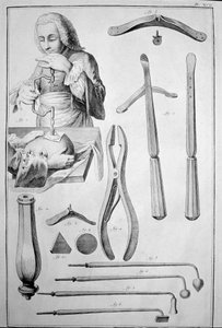 Trepanering af kraniet, forskellige instrumenter (gravering af Unknown artist