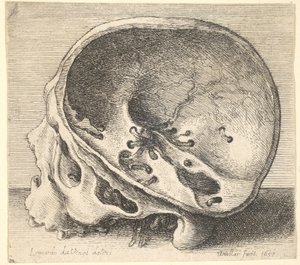 Sektioneret kranium i profil til venstre med venstre side af kraniet fjernet, 1651. af Wenceslaus Hollar