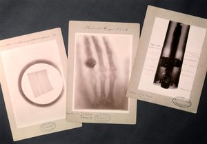 Originale røntgenbilleder af Roentgen, der viser (radiografi) af Wilhelm (after) Röntgen