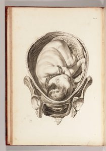 Indgravering af et barn i livmoderen fra "Et sæt anatomiske tabeller, med forklaringer og en forkortelse af jordemoderpraksis", 1754 af William Smellie