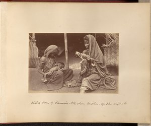 Barn født af sultramt mor - Alder: 3 måneder, vægt: 3 pund. af Willoughby Wallace Hooper