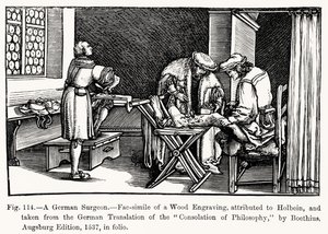 En tysk kirurg, fra Consolation of Philosophy af Boethius, illustration fra Videnskab og litteratur i middelalderen og renæssancen, skrevet og indgraveret af Paul Lacroix, 1878 (bw ph)