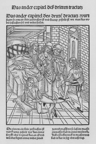 The Book of Cirurgia af Hieronymus Brunschwig (litho) af (after) German School