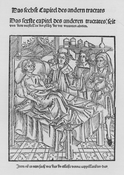 The Book of Cirurgia af Hieronymus Brunschwig (litho) af (after) German School