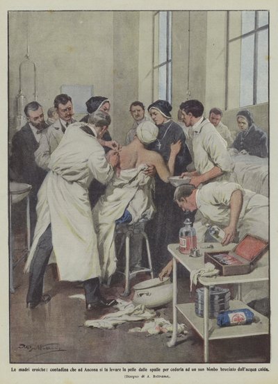 Heltemodige mødre, en bondepige i Ancona, der får fjernet sin hud fra skuldrene for at give den til en af sine egne? af Achille Beltrame