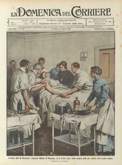 I en beundringsværdig handling af altruisme har arbejdstager Ghezzi fra Piacenza fået fjernet en del af sin hud ? af Achille Beltrame