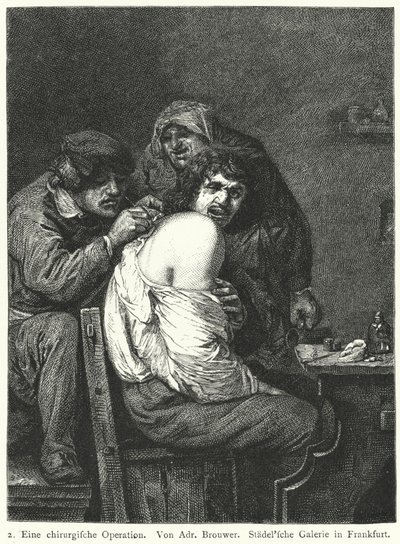 Rygoperationen af Adriaen (after) Brouwer