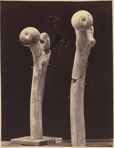 Prøver af skudfrakturer på lårbenet, ca. 1867 (foto) af American Photographer