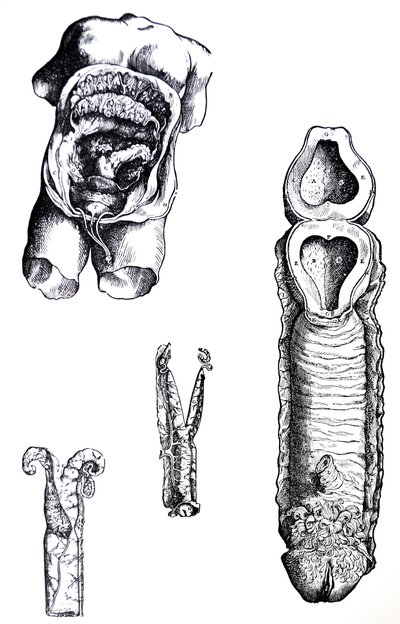 Pladerne fra den femte bog af De Humani Corporis Fabrica af Andreas Vesalius