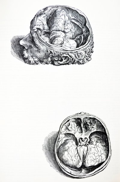 Pladerne fra den syvende bog af De Humani Corporis Fabrica af Andreas Vesalius