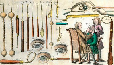 Kirurgi i det 18. århundrede: øjenoperation. Instrumenter til operation af grå stær og kunstig pupildannelse. Indgravering i "Institutions chirurgicale" af Lorenz Heister af Anonymous Anonymous