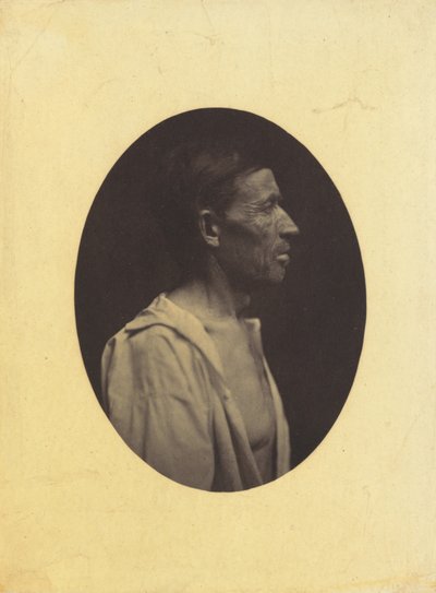 Et portræt, set i profil, af en mand 42 år gammel, bedøvet over misbrug af alkohol..., 1854-1856. af Duchenne de Boulogne