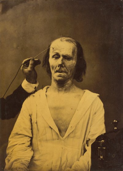 Et afslappet ansigt venstre, dyb opmærksomhed højre, 1854-1856, trykt 1862. af Duchenne de Boulogne