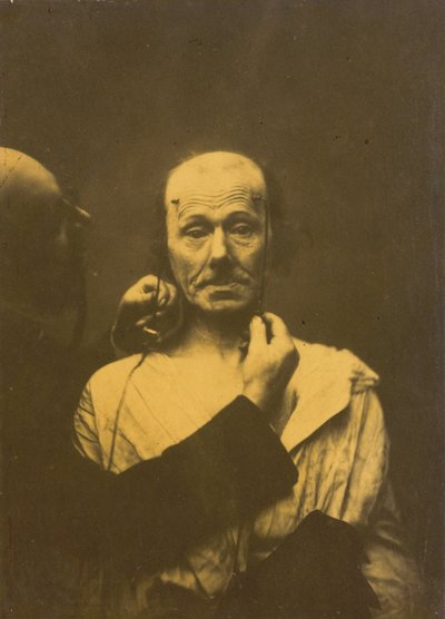 Attention, 1854-1856, trykt 1862. af Duchenne de Boulogne