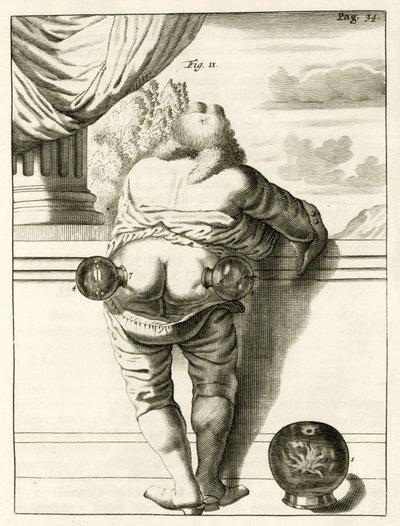 Et eksempel på cupping, fra The Practice of Medicine af Frederik Dekkers, 1694 af Dutch School