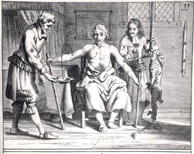 Blodtransfusion fra en hund, fra Armamentarii Chirurgici af Johannes Schultes (1595-1645) udgivet i Amsterdam, 1671 af Dutch School