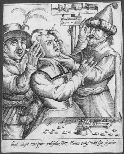 Trepanning, graveret af H. Weydmans (1500-tallet) af Dutch School