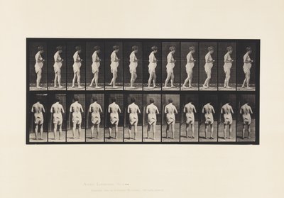 Plade 542. Multipel Cerebro-Spinal Sklerose - Gå af Eadweard Muybridge