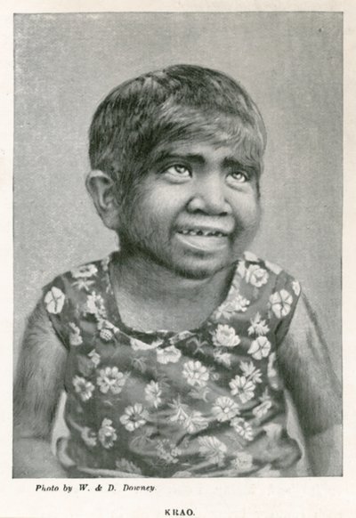 Krao, The Missing Link, udstillet på Aquarium, Westminster, London, i 1887 af English Photographer