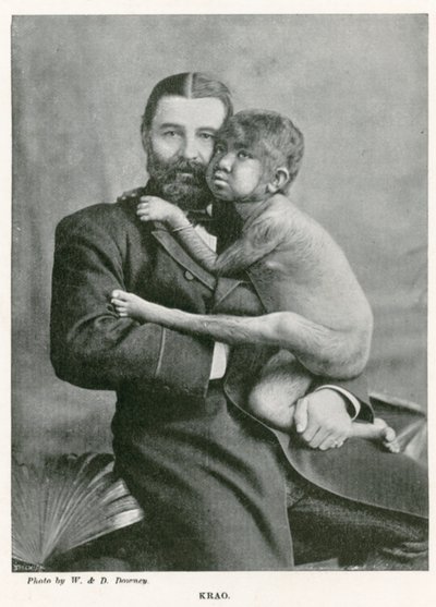 Krao, The Missing Link, udstillet på Aquarium, Westminster, London, i 1887 af English Photographer