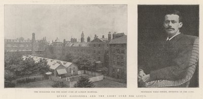 Dronning Alexandra og lyskuren mod lupus af English Photographer