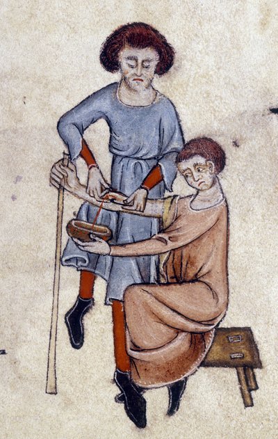 Blood Letting, fra Luttrell Psalter, ca. 1325-35 (vellum) af English School