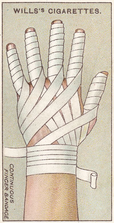 Kontinuerlig Fingerbandage, nr. 48 fra First Aid-serien af Willss Cigarette-kort, 1913 af English School