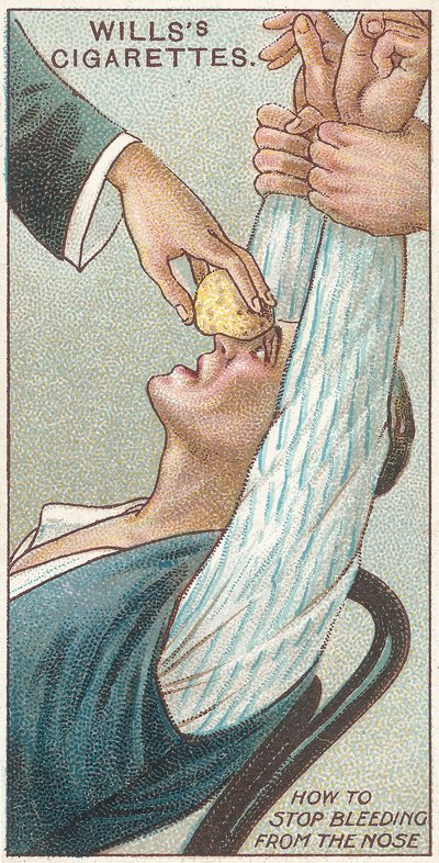 How to Stop Bleeding from the Nose, nr.31 fra First Aid-serien af Willss Cigarette-kort, 1913 af English School