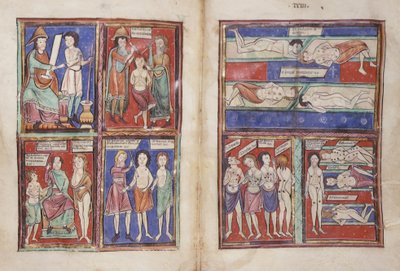 Sloane 1975 fol.91v-92 Medicinske scener af English School