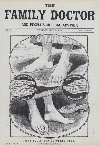 Enge Stiefel und deformierte Füße von English School