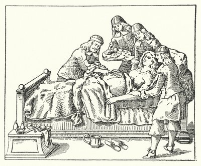 En kejsersnitoperation i det syttende århundrede (gravering) af European School