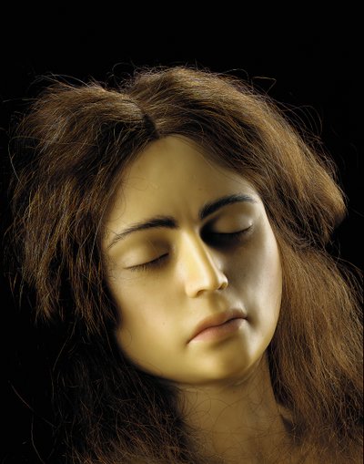 Anatomisk model af en ovariegraviditet, detaljer af European School