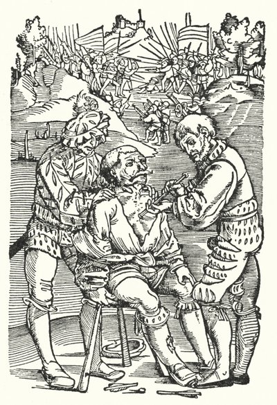 Barberkirurg, der fjerner en pil (gravering) af European School