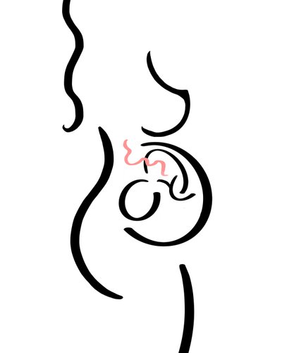 Gravid (digital kunst) af Evan Sklar