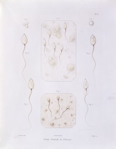 Sædvæske, fra Theorie Positive de lOvulation Spontanee et de la Fecondation des Mammiferes et de lEspece Humaine af Felix-Archimede Pouchet (1800-72) graveret af Oudet, Paris, 1847 (farvet eng. af Felix Archimede Pouchet
